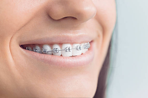 Best Dental Fillings (Composite and Amalgam)  in Abingdon, MD